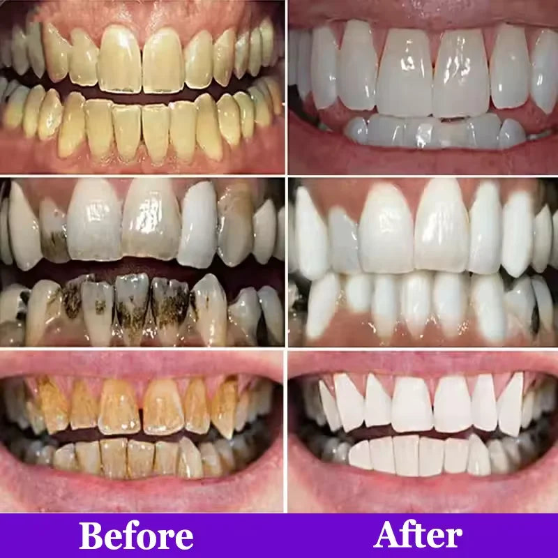 Purple Teeth Whitening Strips Remove Plaque Stains Cleaning Oral Hygiene Bleaching Dental Tools Fresh Breath Brighten Tooth Care